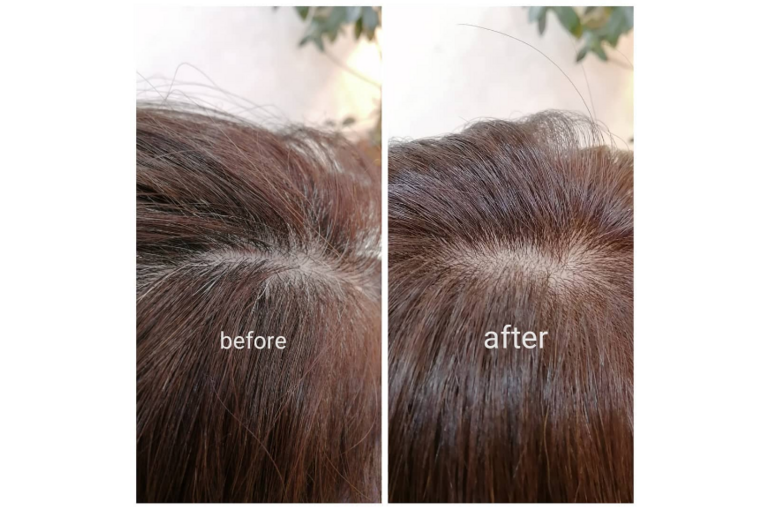 Screenshot_2022-03-08 コバヤシ ノブユキ( kobanobu0325) • Instagram写真と動画(1)